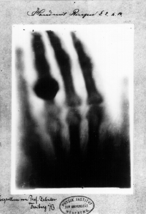 First medical x-ray Rӧntgen