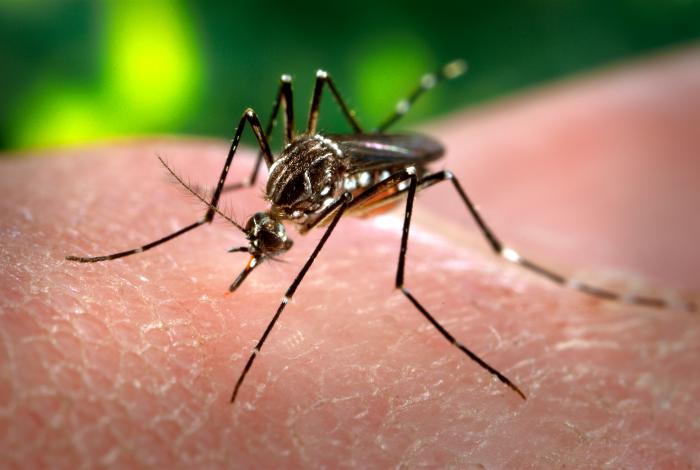 First U.S. Case Of Brain Damage Linked To Zika Virus
