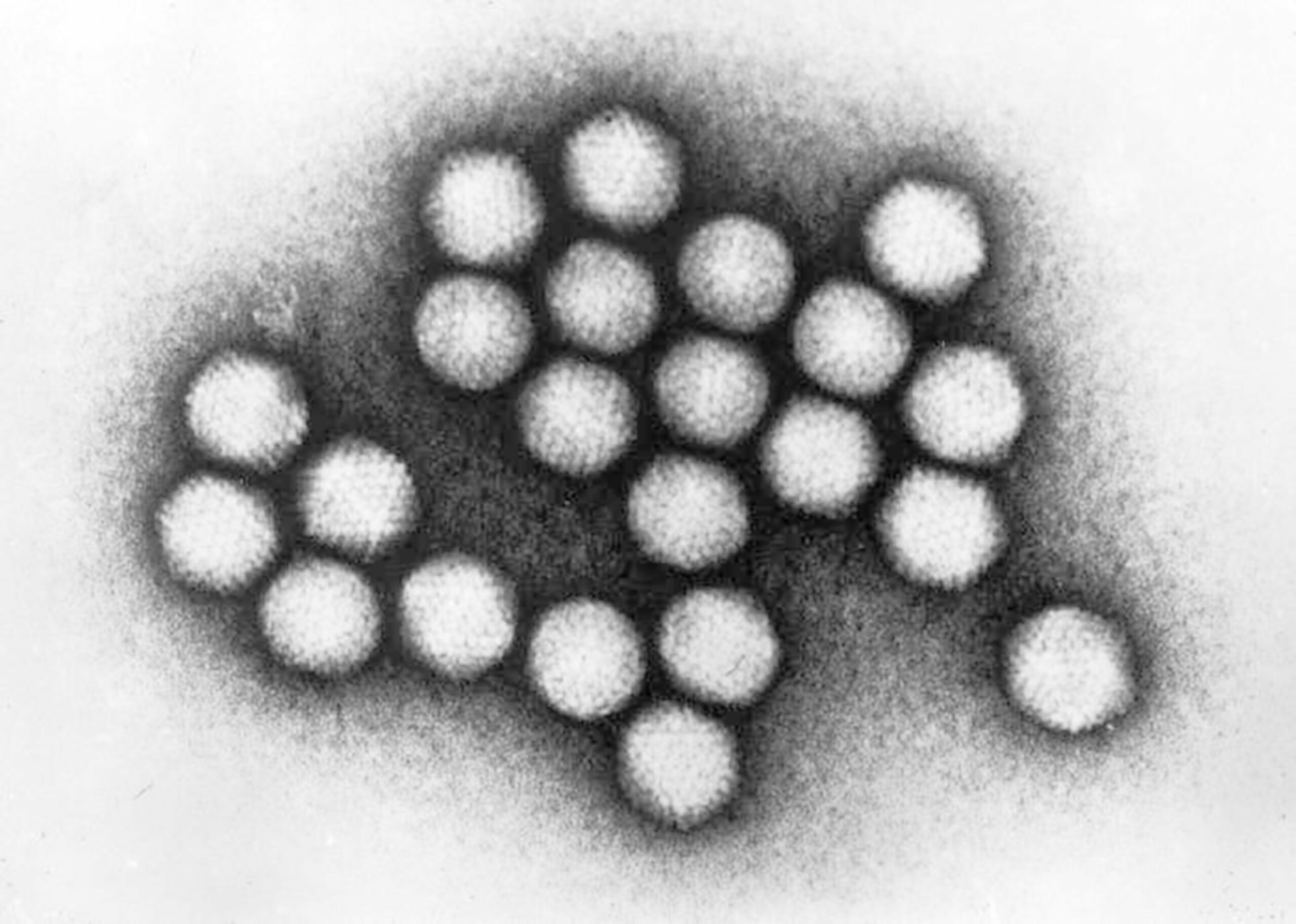 Adenovirus is normally harmless—here’s why some outbreaks turn deadly