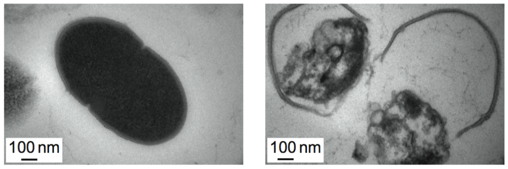 On the left, a healthy <em>Enterococcus faecalis</em> bacteria cell; on the right, a destroyed cell, with a ruptured wall and leaky contents clearly visible. Enterobacteria like this one — and like salmonella and e. coli — are found in the intestinal tract.
