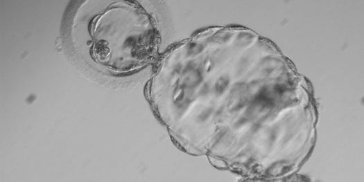 Cloned Human Embryo Study Comes Under Fire