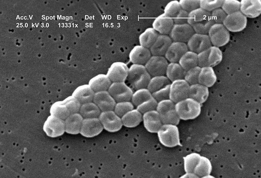 In Blitz to Kill One Kind of Infectious Bacteria, Other Untreatable Strains Emerge