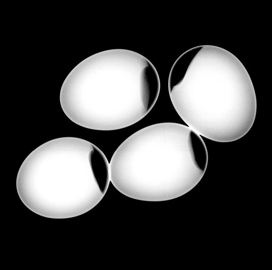 They're eggs, and the black parts are air cells. (In case you're curious, an air cell forms when an egg loses water and CO2 through its pores -- it pulls in the surrounding air to replace the lost volume.) When radiologists take an x-ray, they fire the radiation at an object that's either on top of or in front of an x-ray detector. If the rays don't reach the detector -- meaning they were absorbed by the densest parts of object, like the meaty section of an egg -- that area shows up white on the resulting image. If the rays encounter no resistance, they hit the detector and show up completely black, like in the airy part of the eggs. If the rays hit soft tissues and get partially absorbed, it creates a gray color in the image.