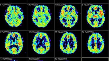 An Algorithmic Screwup May Have Made A Lot Of fMRI Data Invalid