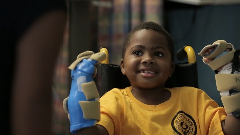 8-Year-Old Boy Receives Double Hand Transplant