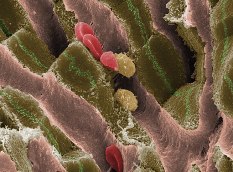 This electron microscope image shows the internal structure and specialist regions of liver tissue from an adult mouse. Red blood cells and specialist immune cells are seen in the sinusoids, pink structures running through the tissue for circulation. Liver cells, shown in brown, are arranged in plates surrounding the sinusoids. Bile is secreted into the green channels between adjacent hepatocytes on its way to the small intestine. [<a href="http://www.wellcomeimageawards.org">Wellcome Image Awards</a>]