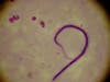 Wuchereria bancrofti, a species of filarial worm responsible for 90% of Lymphatic filariasis cases.