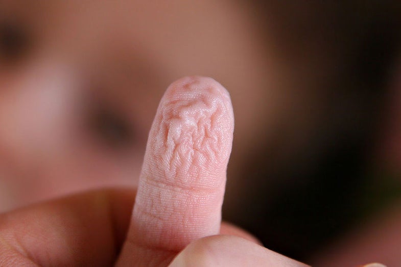 The Mystery of Wrinkly-When-Wet Fingers, Solved