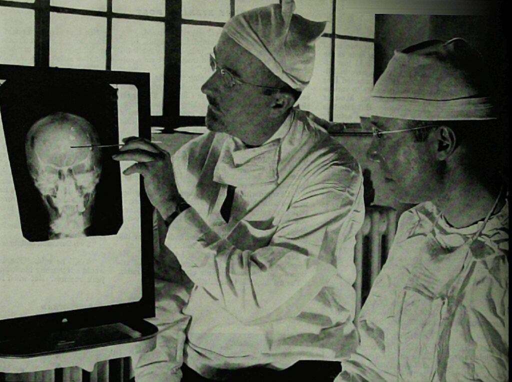 The transorbital lobotomy is a pretty brutal practice. In 1946, Dr. Walter Freeman (left) created the procedure, in which physicians hammer an ice pick through the eye socket into the brain to sever nerve fibers in the frontal lobe. Despite lacking concrete evidence to prove its efficacy, Freeman's emphatic promotion led to the procedure's proliferation. Shoddy lobotomies—sometimes performed on unwilling patients—led to paralysis, brain death, and in some cases fatality. More effective drugs and surgeries were introduced to better tailor treatment, but the procedure, when performed correctly, <a href="https://www.popsci.com/science/article/2013-03/fyi-do-lobotomies-work/">worked for some patients</a>.