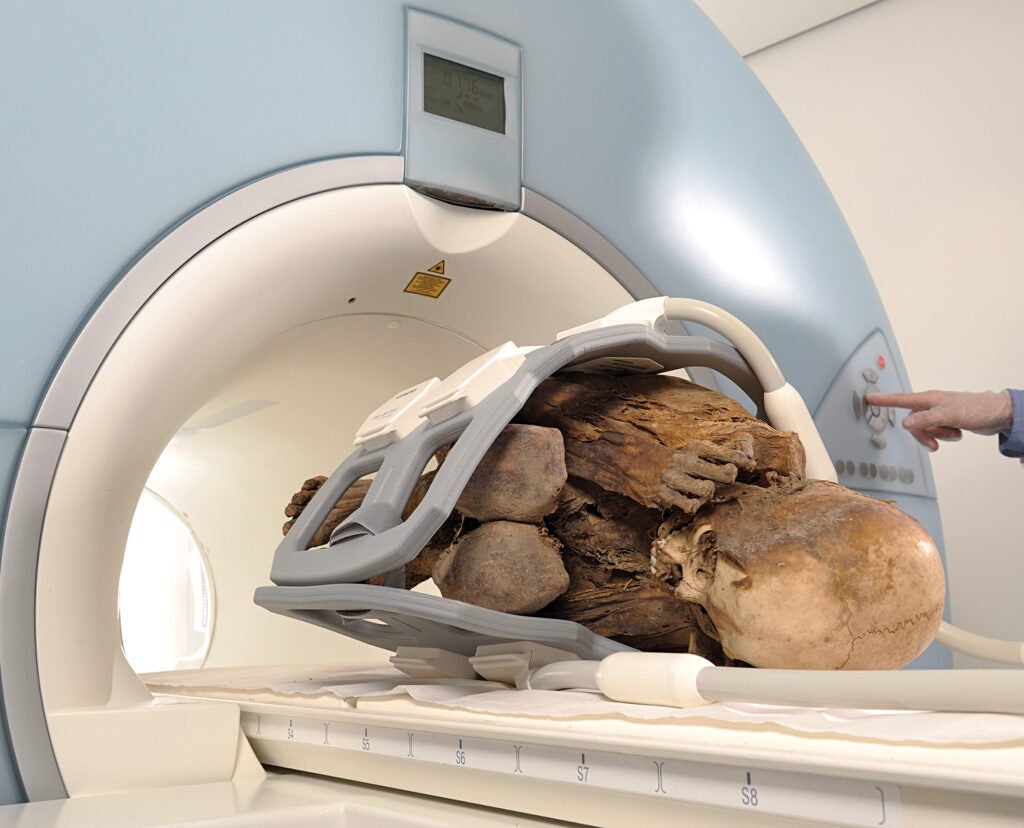 Researchers use magnetic resonance imaging to see inside mummies, such as this one from ancient Peru.