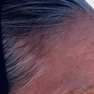 Why Does Hair Turn Gray?