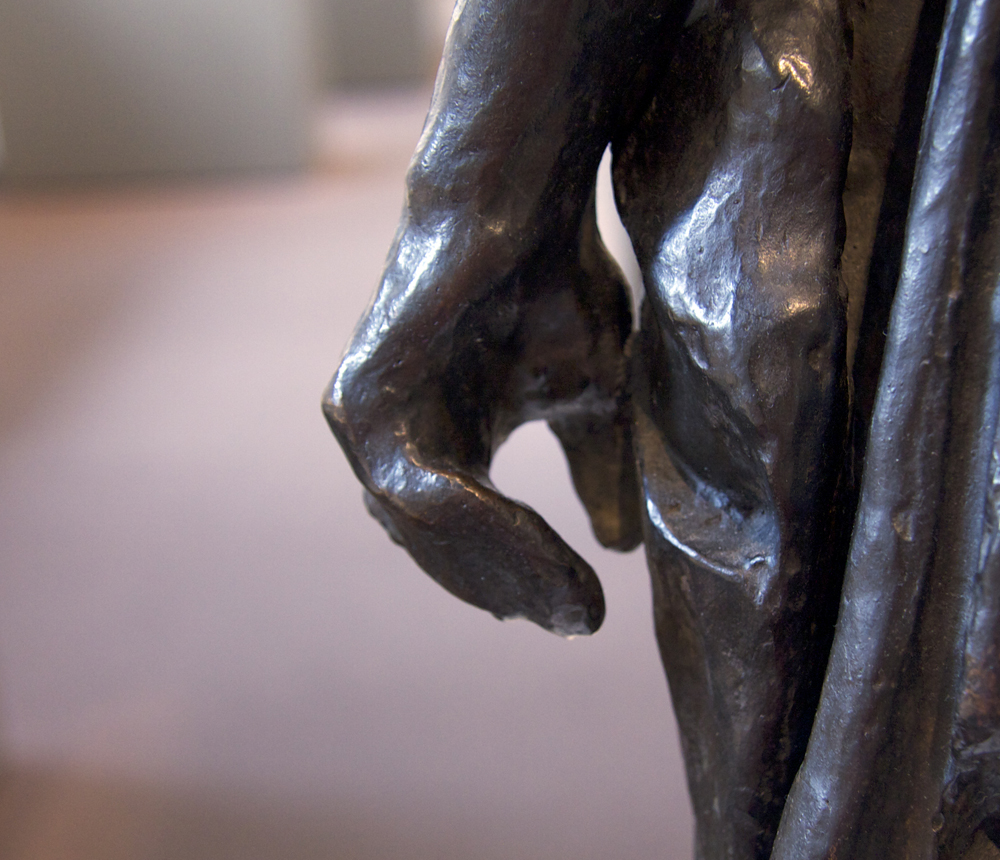 How Surgeons Are Learning From The Hands Rodin Sculpted