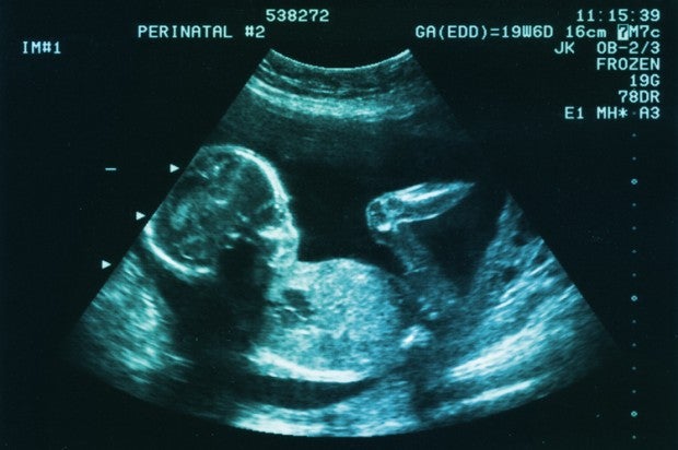Fetal Pain Is A Lie: How Phony Science Took Over The Abortion Debate
