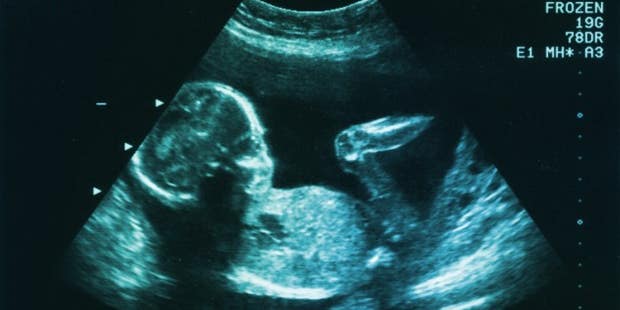 Fetal Pain Is A Lie: How Phony Science Took Over The Abortion Debate