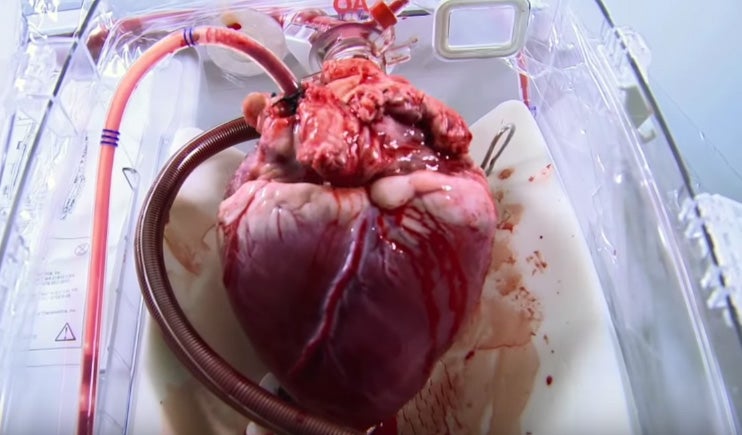 Device Revives Disembodied Hearts That Have Stopped Beating