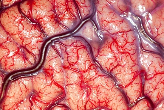 This image (the 2012 overall winner) was taken during an intracranial procedure to attach a surface electrode to the brain of an epilepsy patient. Note: this image has been rotated 90 degrees here to fit our image format. It can be viewed in its original vertical orientation <a href="http://www.wellcomeimageawards.org/index.htm#">here</a>.