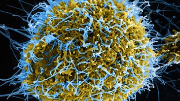 ZMapp: The Experimental Ebola Treatment Explained