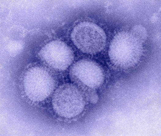 First-Ever Supercomputer Sim of the H1N1 Virus Gives Researchers Resolution Down to the Atom