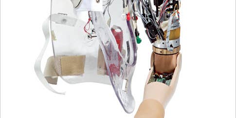 Neuro-Controlled Bionic Arm
