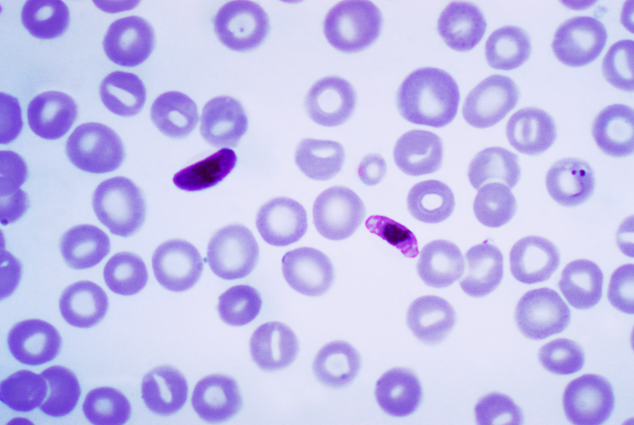 Drug Flags Malaria-Infected Cells For Destruction
