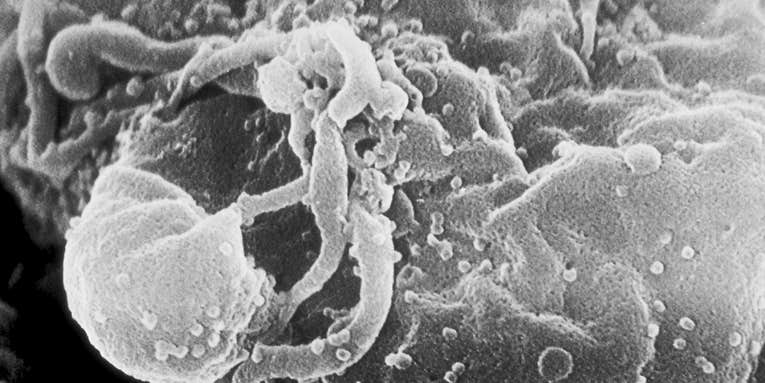 Disarming HIV Could Protect the Immune System and Potentially Lead to a Vaccine, New Study Shows