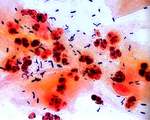 Lactobacilli from a vaginal swab. Traditionally, scientists have considered healthy vaginal microbial communities to be those dominated by this type of bacteria.