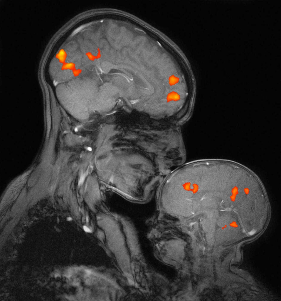 fMRI image of mother and child