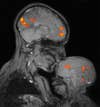 fMRI image of mother and child