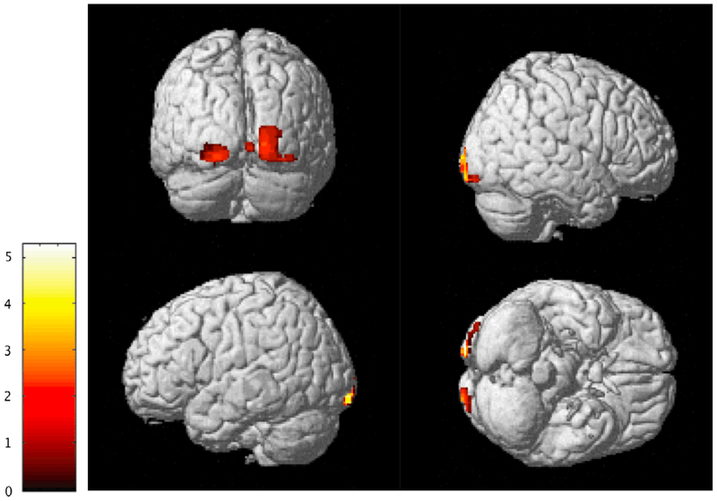 More Empathetic People Have Physically Different Brains