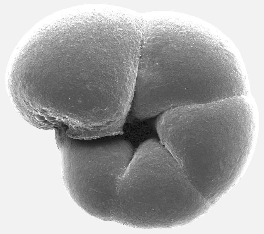 Scanning electron microscope image of a common species of salt-marsh foraminifera.