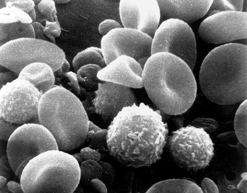 Spotting Cancer Cells in Blood With a 27-Picosecond Camera
