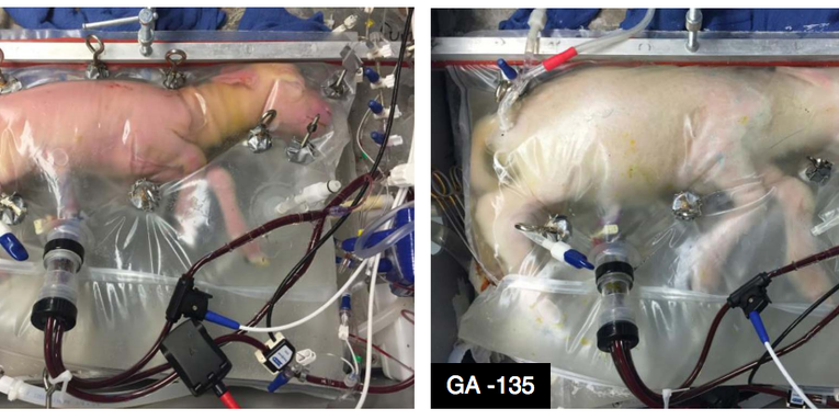 This ‘artificial womb’ is like science fiction—but uteruses aren’t out of a job yet