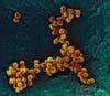 Beyond occupying open wounds, colonies of staph can thrive in water more than six times saltier than Earth's oceans.