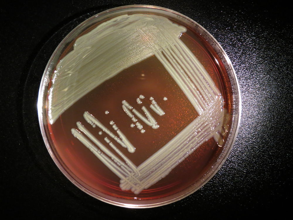 What Is Causing Deadly Bacterial Infections In Wisconsin?