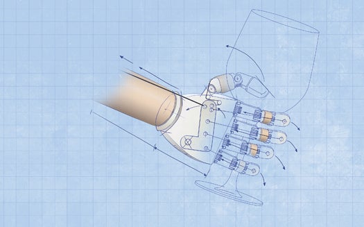 The prosthetic hand attaches to a cable that runs from a shoulder harness worn by an amputee. A lever on the palm opens all five fingers at once, and separate cables in each finger and springs at each knuckle allow the fingers to close individually and bend around objects with a secure grip.