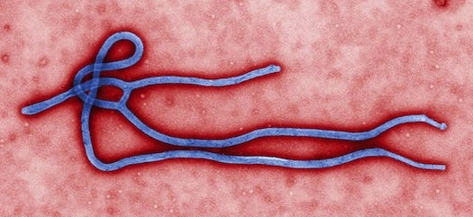 An electron micrograph of an Ebola virion, with added color.