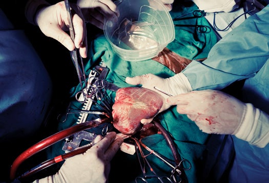 Before installing an artificial heart, surgeons must remove the real one.