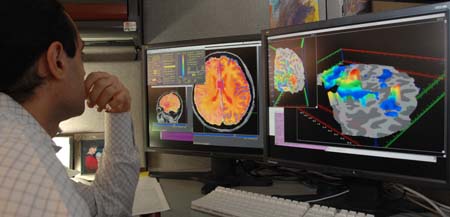 Brain Scans Could Identify Depression Before Symptoms Emerge