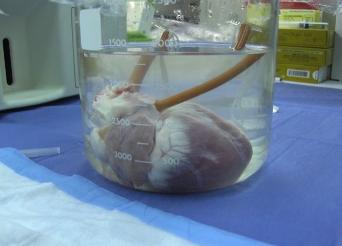 Chemical Cocktail Keeps Resurrected Heart Alive for 10 Days Outside of Body