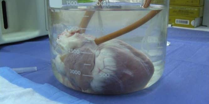 Chemical Cocktail Keeps Resurrected Heart Alive for 10 Days Outside of Body