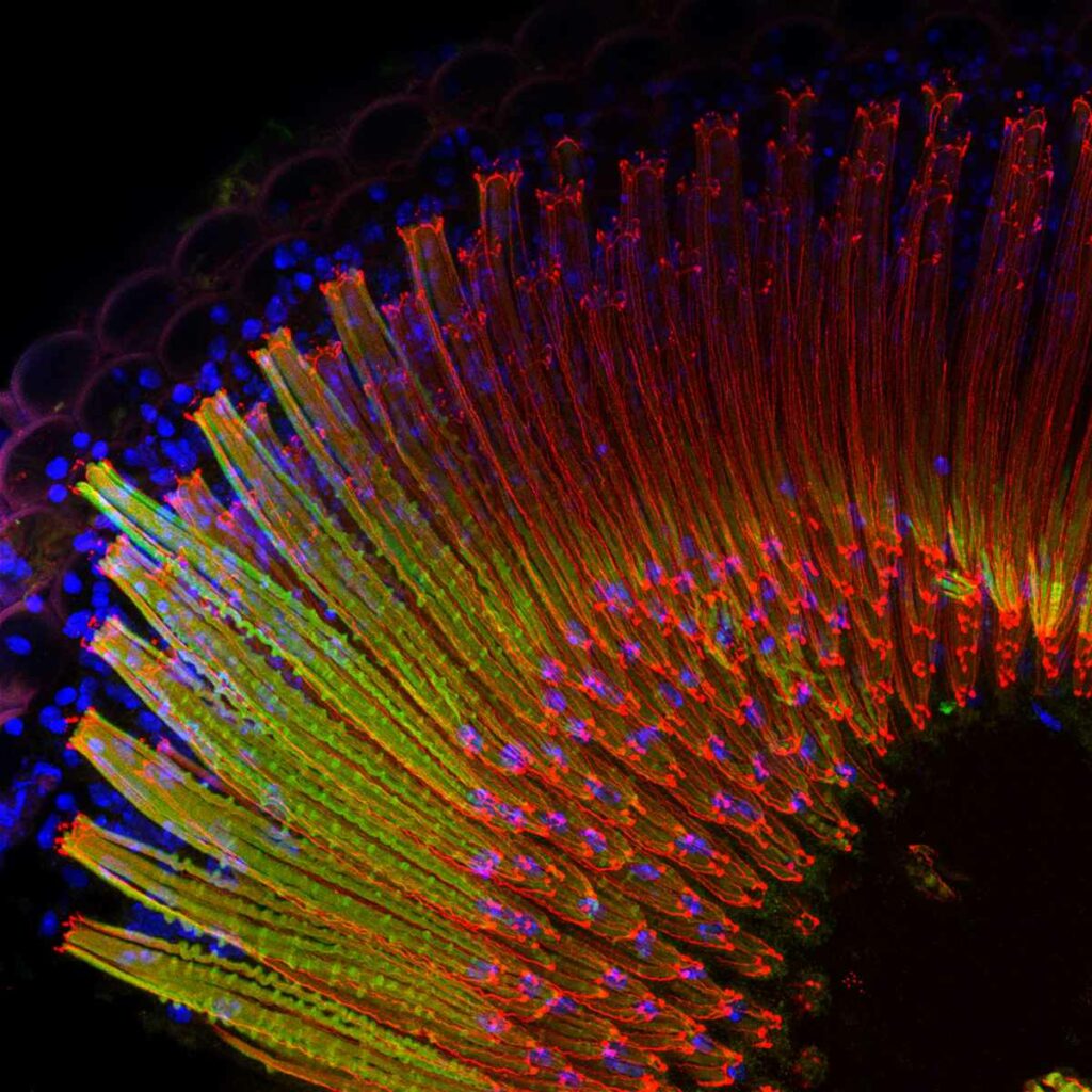 Neuroscientist Karin Panser took this beautiful, rainbow-fied image of a fruit fly's eye. It took top honors for the Huygens Image Contest 2013, which honors great microscopic images. <em>From January 17, 2014</em>