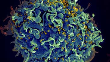 Why It’s Too Soon To Say HIV Has Been Cured