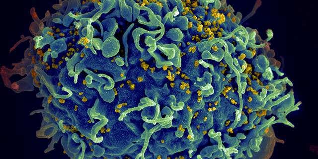 Why It’s Too Soon To Say HIV Has Been Cured