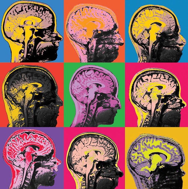 MRI images of the human brain