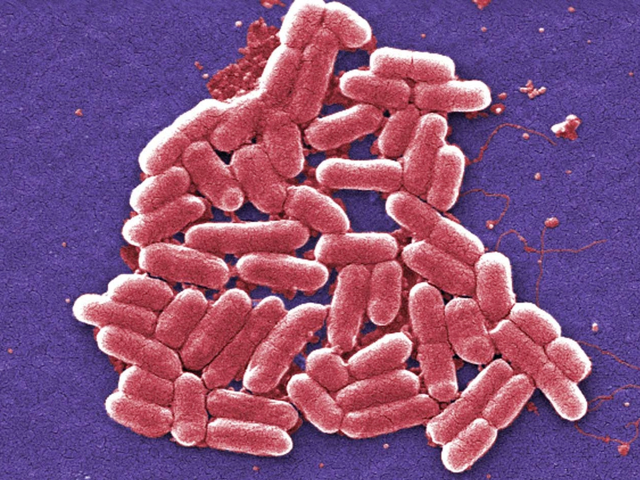 Redesigned E. Coli Resists Viruses And Might Make GMOs Safer