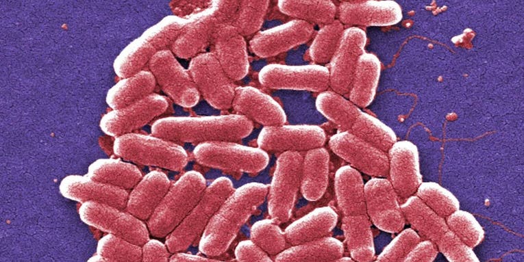 Redesigned E. Coli Resists Viruses And Might Make GMOs Safer