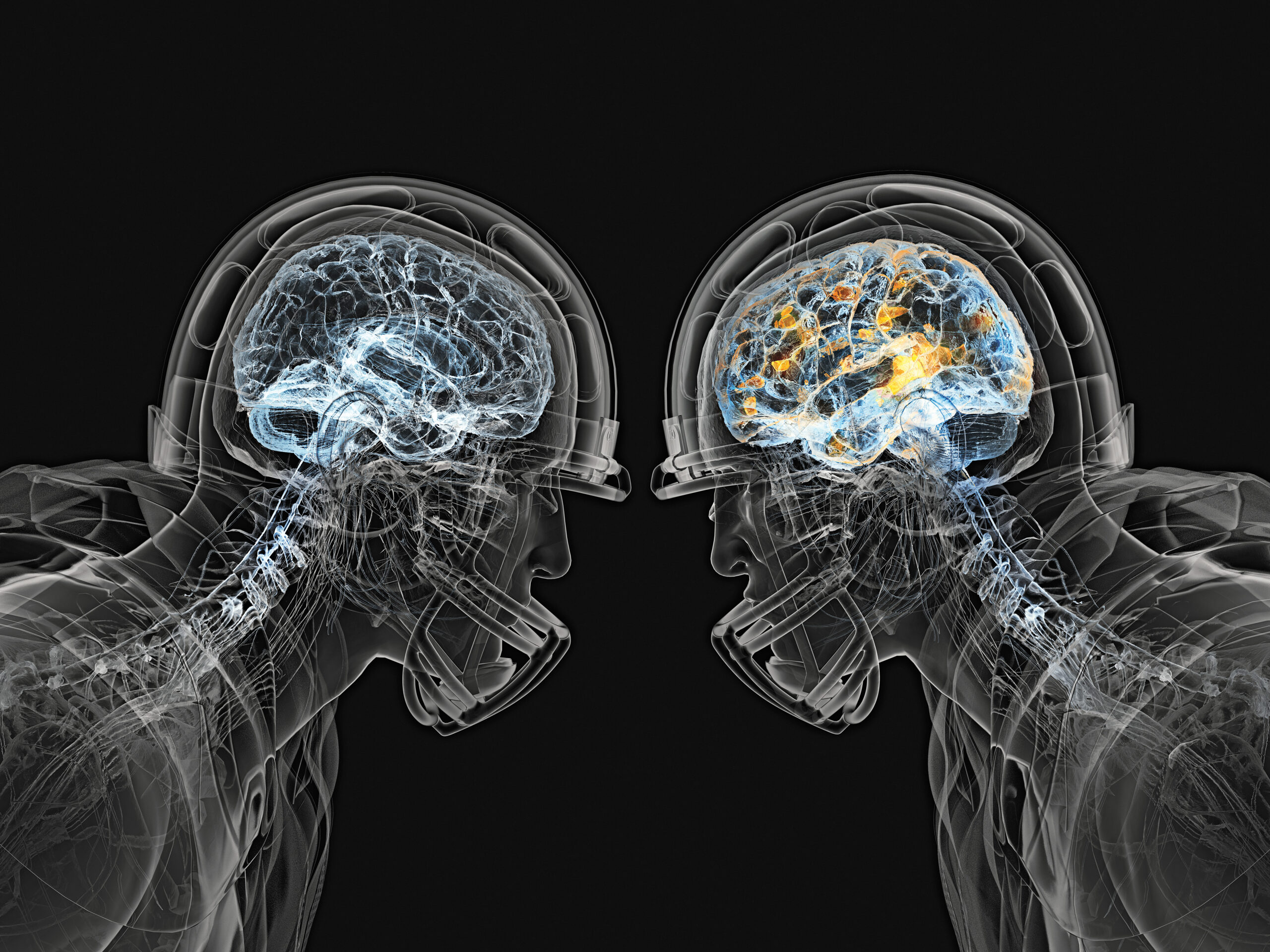 Tackling Brain Trauma Head-On