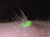 patch of skin grown in lab that glows