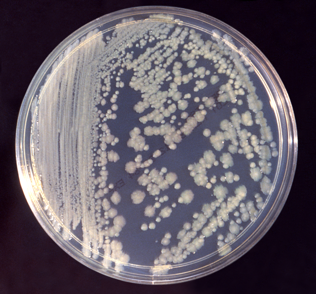 Superbug Outbreak Has Killed Two at UCLA Medical Center