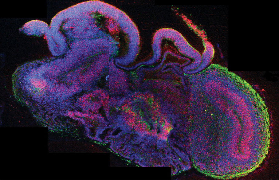 Whoa! Scientists Grow A Brain In A Dish